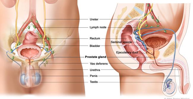 Le sexe après le cancer de la prostate